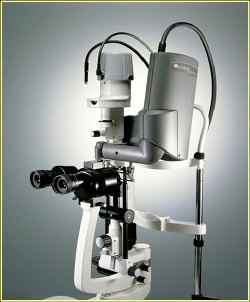 immagine dello strumento SLT (trabeculoplastica laser selettiva)