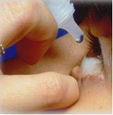terapia medica per il glaucoma: collirio